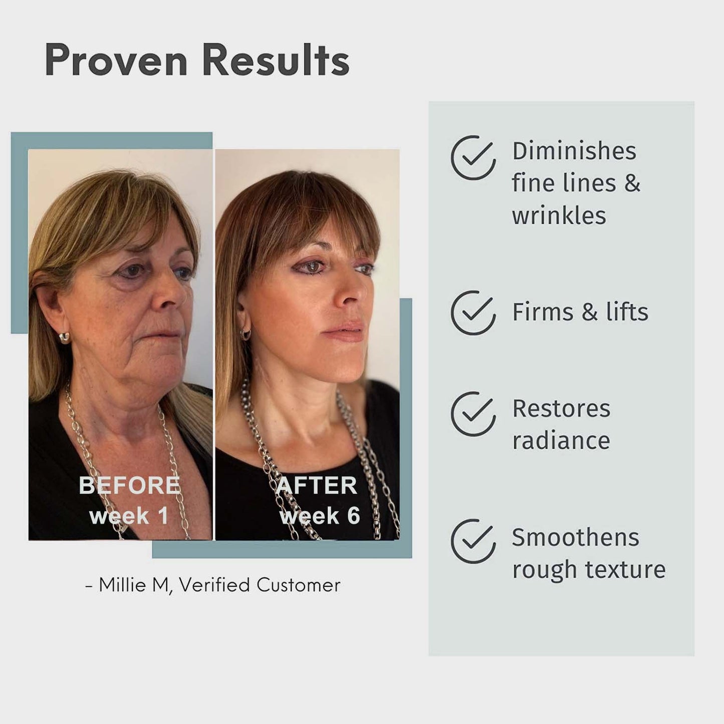 Serum przeciwstarzeniowe RNN™ Advanced Collagen Boost🔥 (Ograniczona czasowo wyprzedaż - pozostało 30 minut)