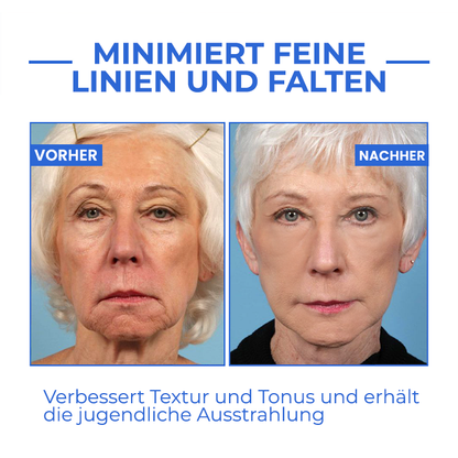 Youthfully™ Botox Gesichtsserum